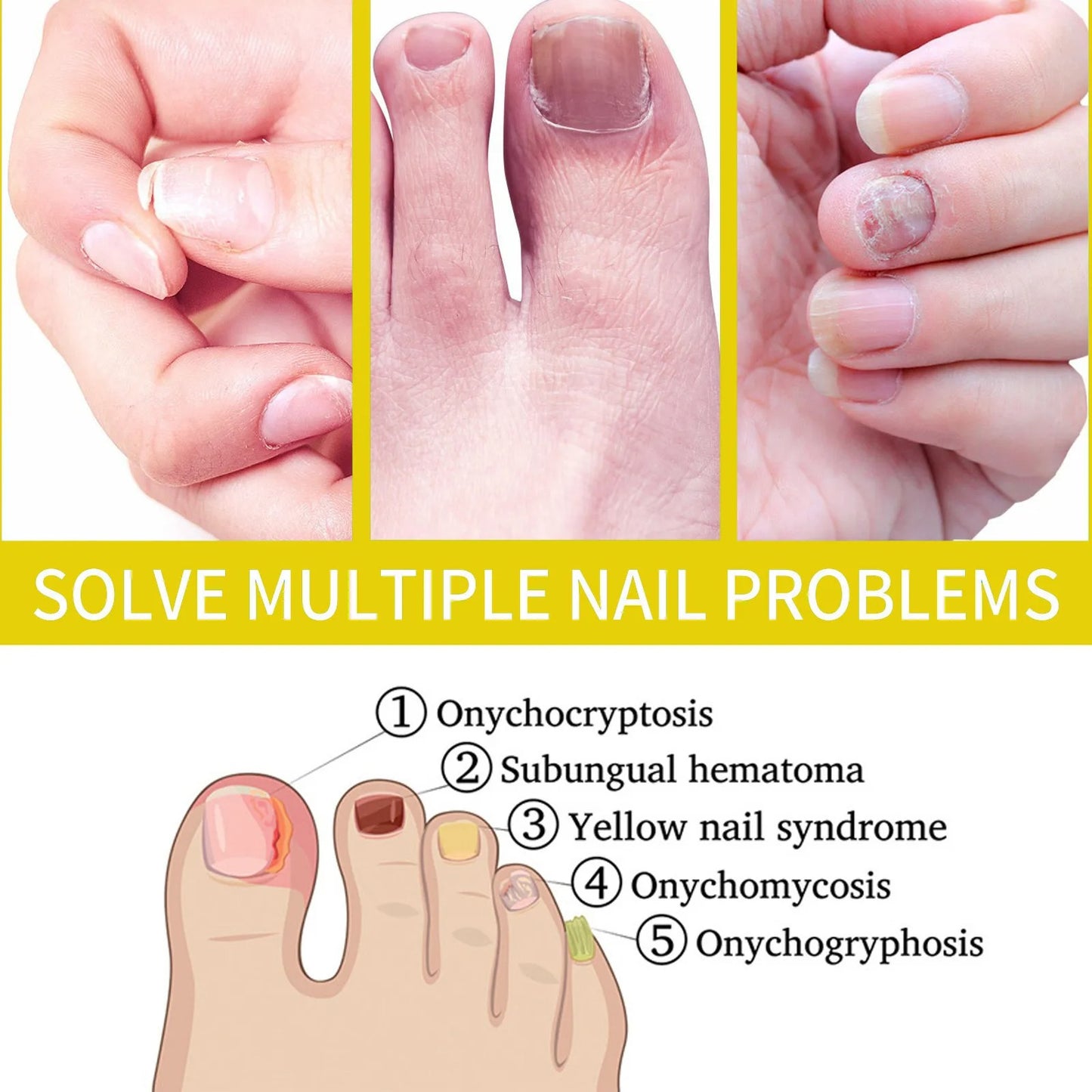 Nail Growth Oil