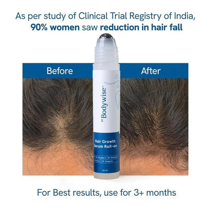 Hair Growth Roller with Rosemary Essence