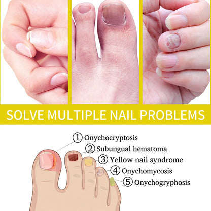 Nail Growth Oil